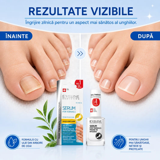 Tratament antifungic pentru unghii